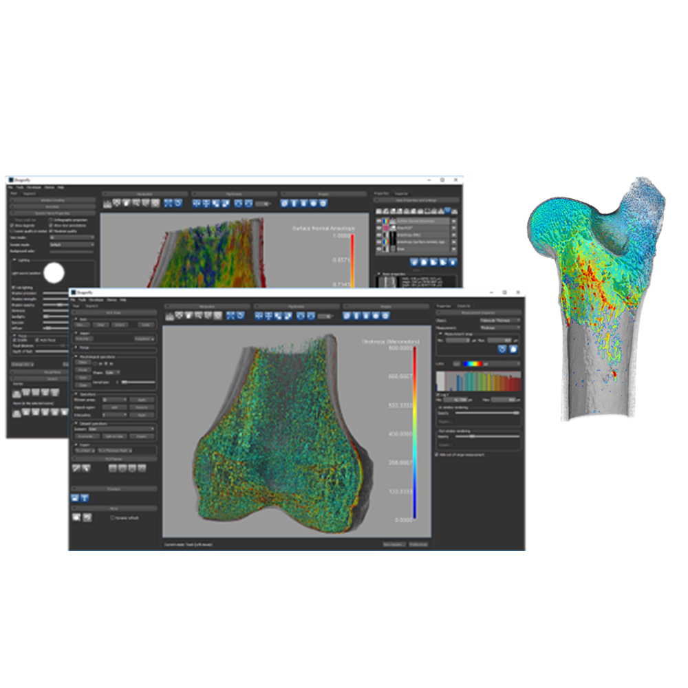 Volume thickness map of trabeculae
