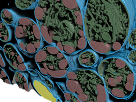 Deep Learning segmentation of mouse retina cell.