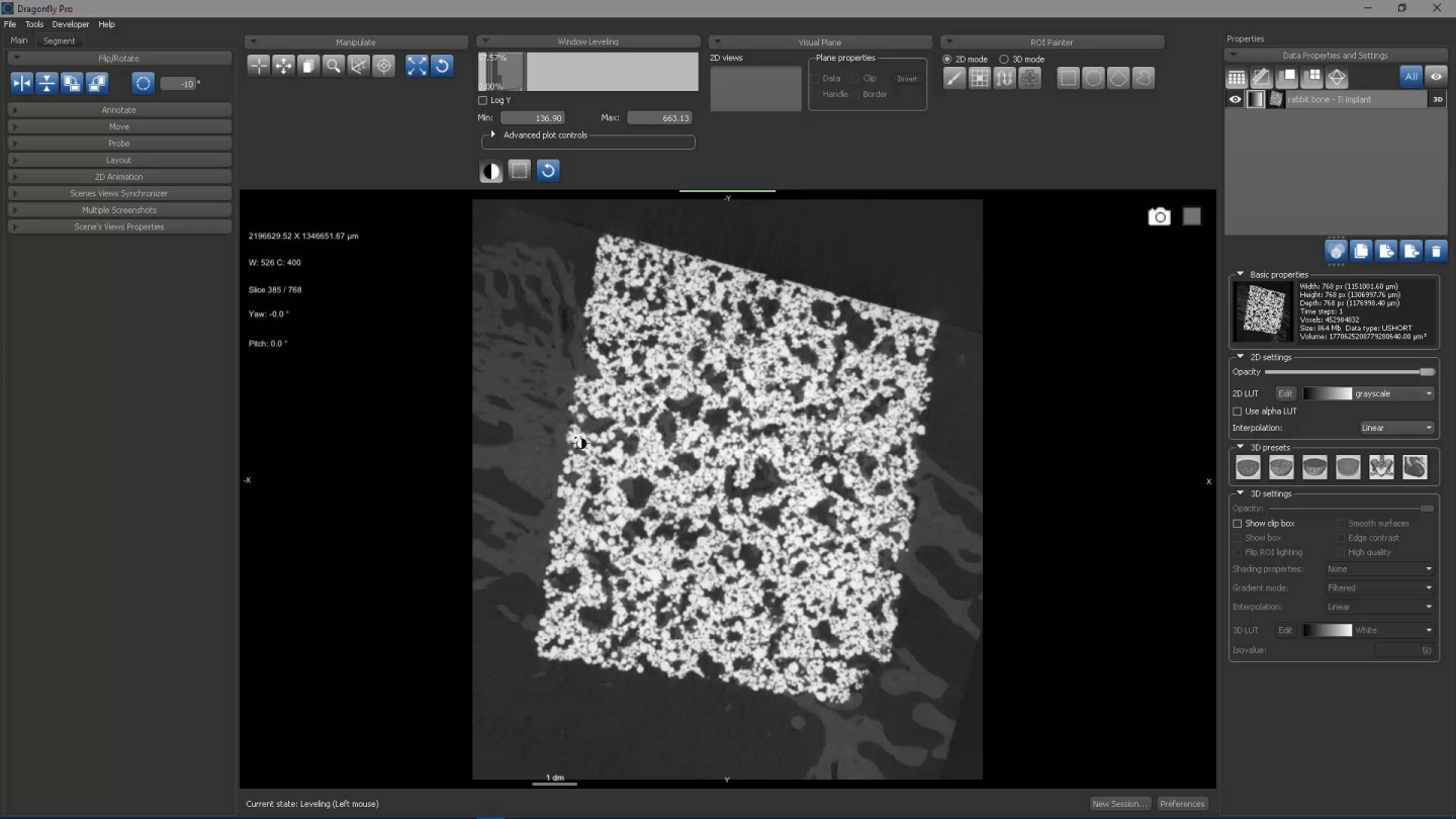 Dragonfly 3D World ZEISS edition