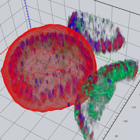 Screenshot 3D Segmentation