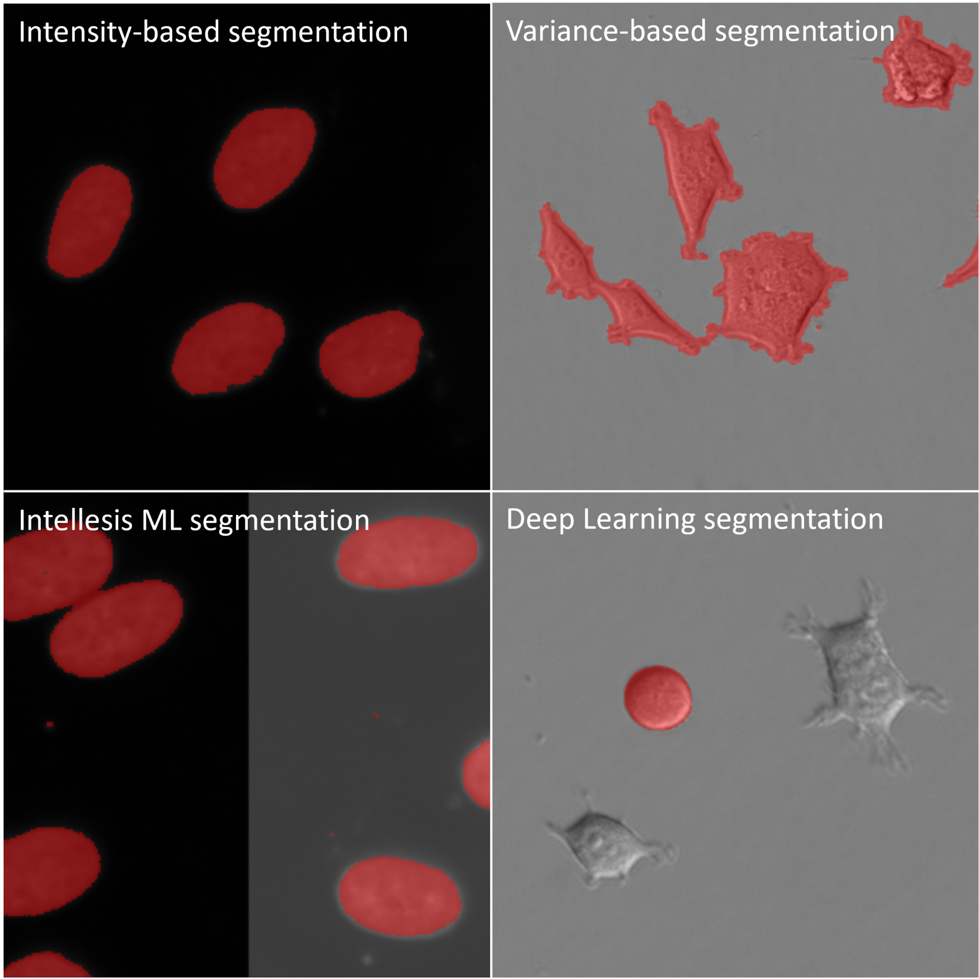 Conventional and AI-based segmentation algorithms