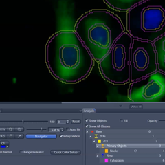 Go to Tutorial Image Analysis: Zone of Influence (ZOI)