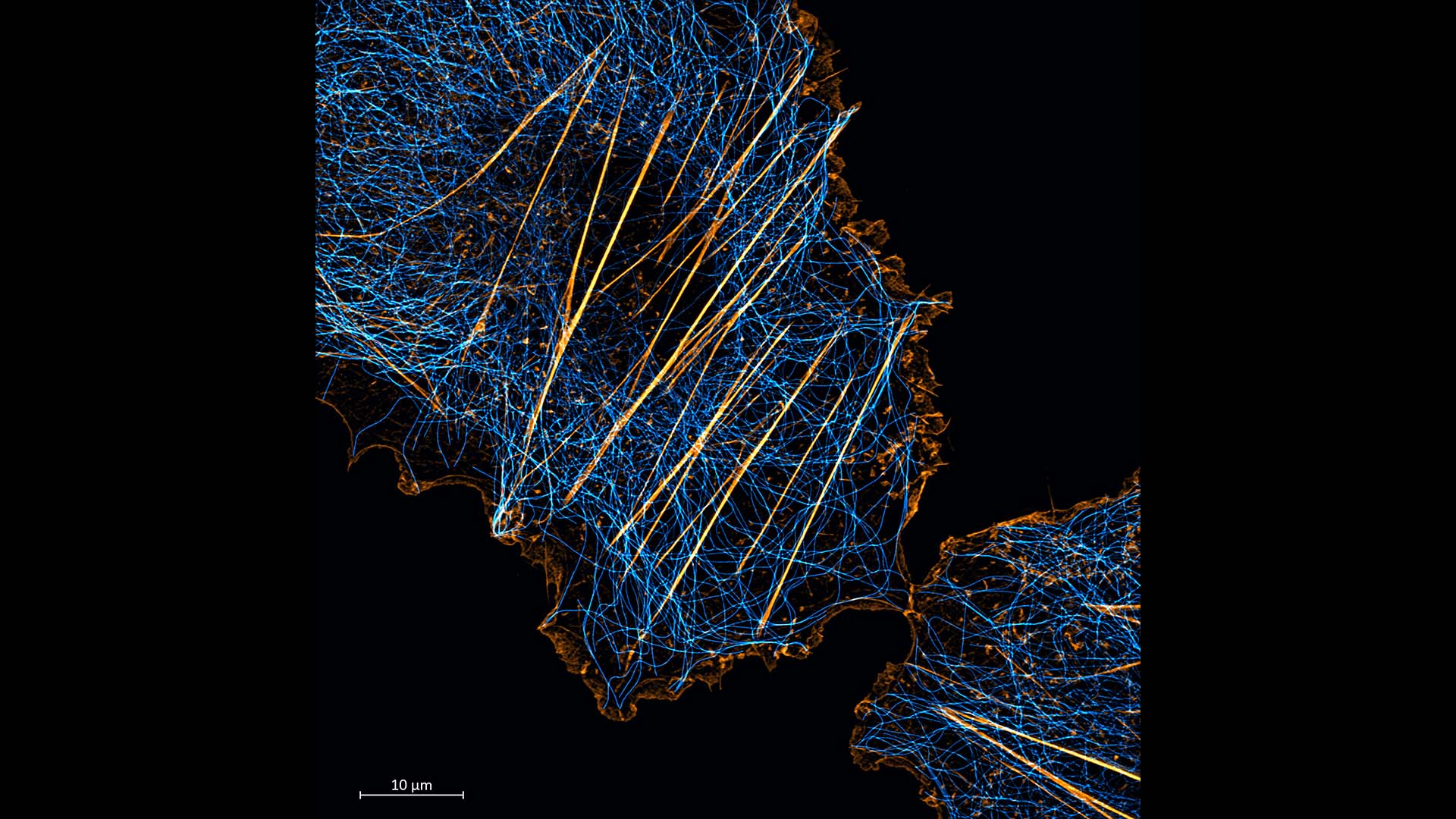 Microscopy image acquired with a Lattice SIM microscopy, which shows Cos-7 cells stained for microtubules (cyan) and actin (orange)