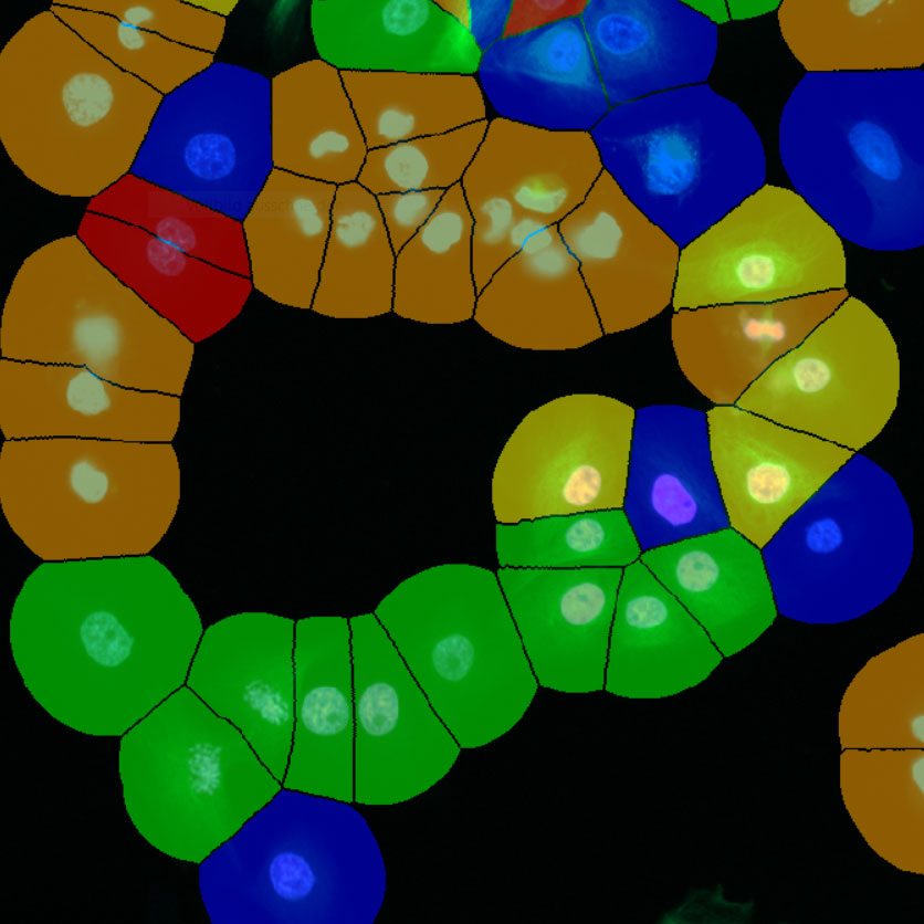 Classification of cellular phenotypes with AI