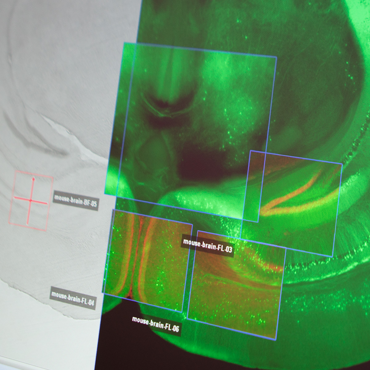 ZEISS ZEN: Microscopía correlativa única