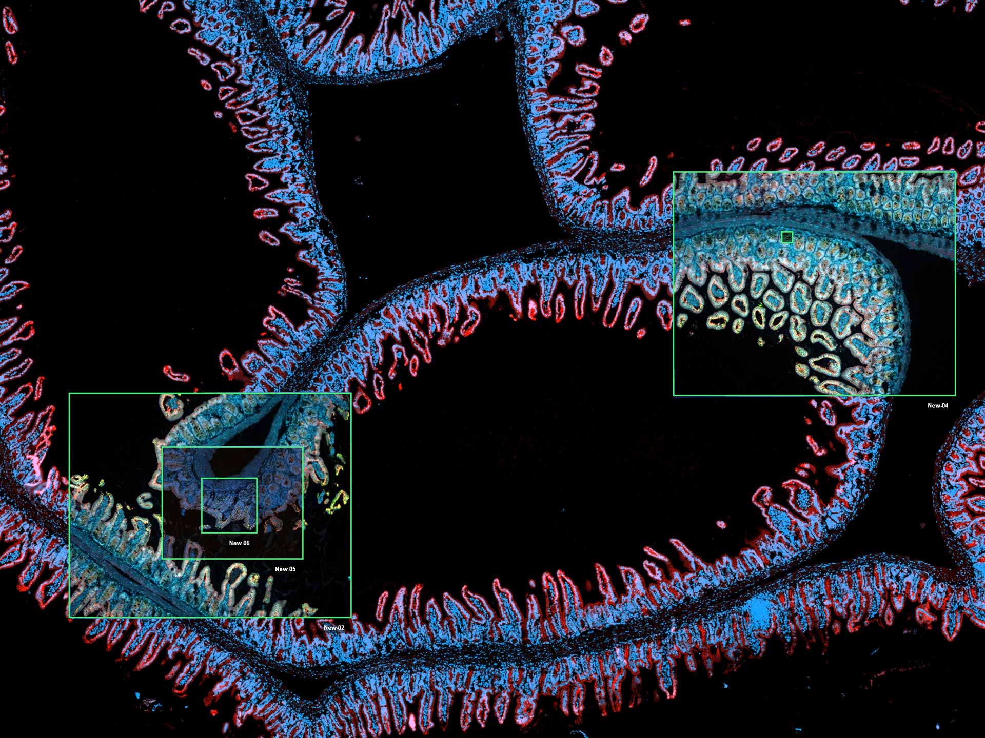 Automated slide scanning and detailed studies  on other ZEISS microscope systems combined in a ZEN Connect project