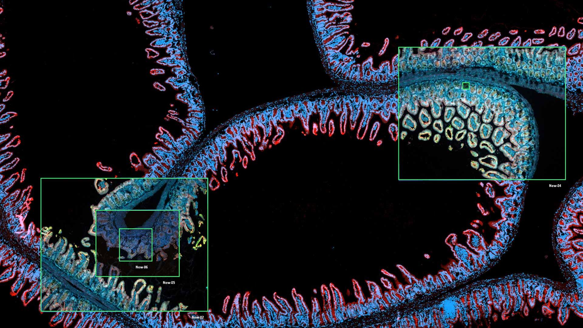 Automated slide scanning and detailed studies  on other ZEISS microscope systems combined in a ZEN Connect project