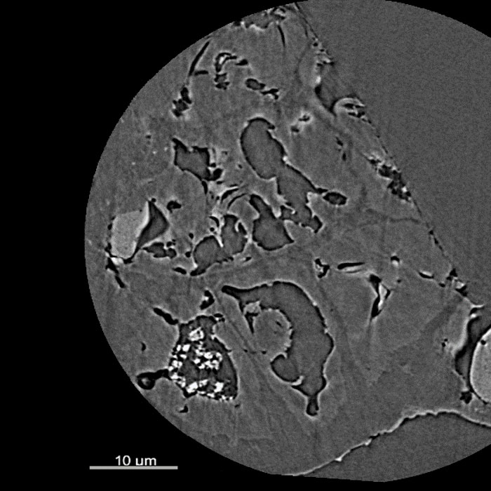 2D reconstructed slice of a pine needle in Zernike phase contrast (ZPC) mode (left).