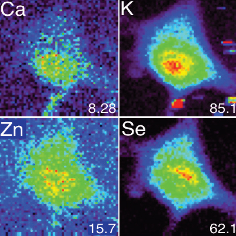 Célula cancerosa humana. Distribución elemental en una célula cancerosa humana. Imagen cortesía de C. Weekley, Universidad de Adelaida.