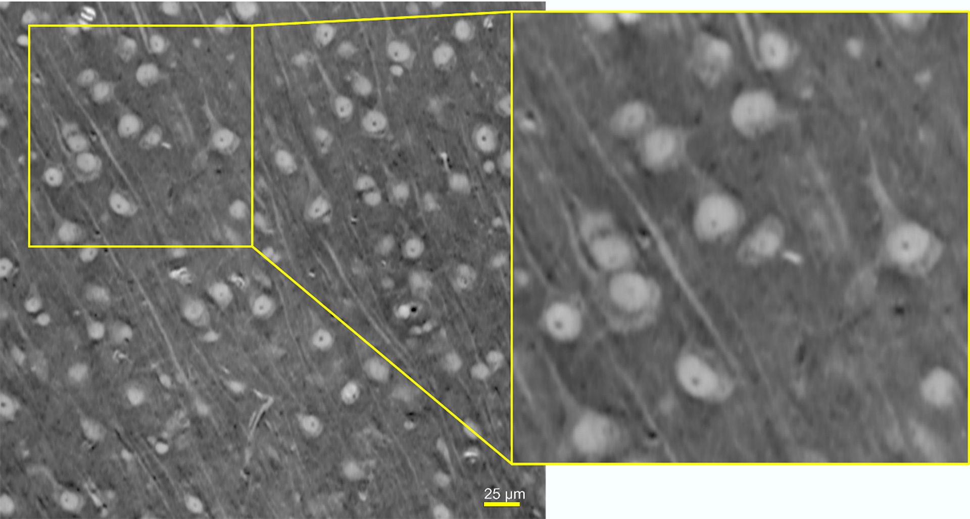 Greyscale image is a single slice from a 3D dataset of a mouse brain that was imaged with the 40×-P objective of ZEISS Versa XRM and reconstructed using ZEISS DeepRecon Pro.
