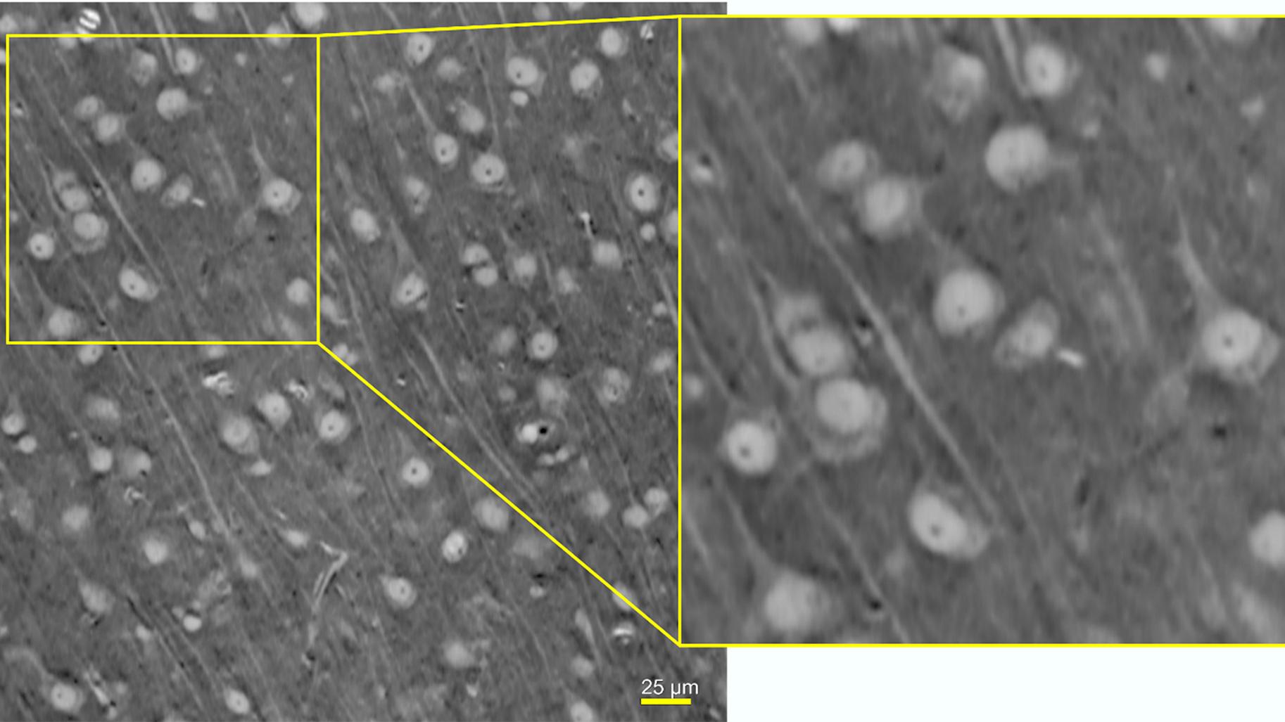 Greyscale image is a single slice from a 3D dataset of a mouse brain that was imaged with the 40×-P objective of ZEISS Versa XRM and reconstructed using ZEISS DeepRecon Pro.