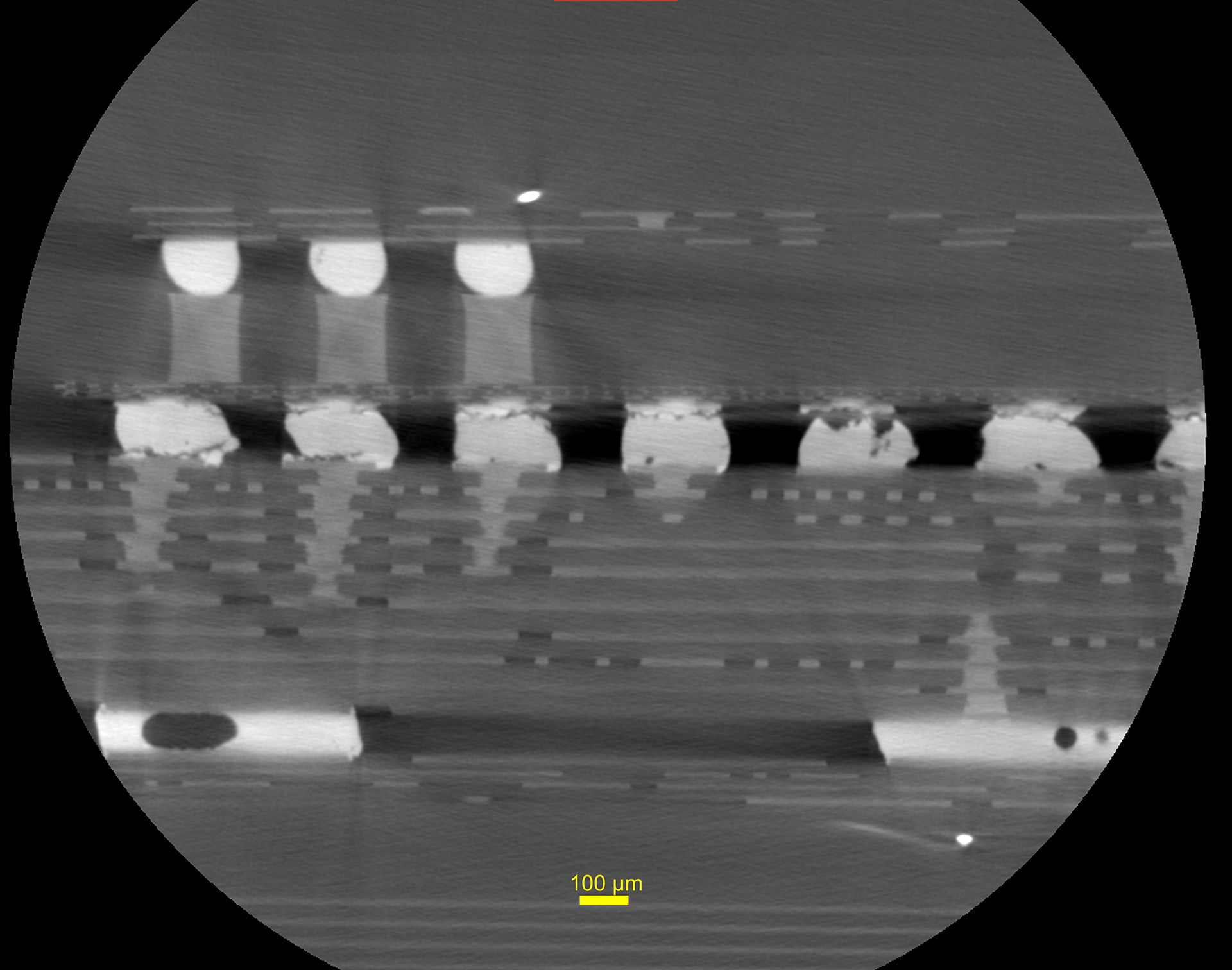 2D slice view of solder fatigue cracks in a thermal cycled smartphone control board at 2.5 μm voxel resolution.