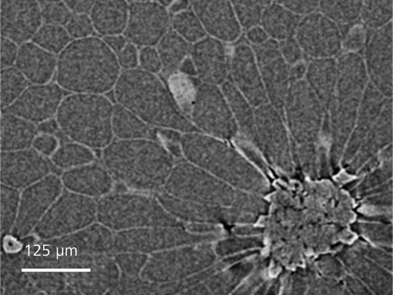 Image d'une poire acquise en contraste de phase, indiquant les détails des parois cellulaires dans des cellules normales et des scléréides (en bas). 