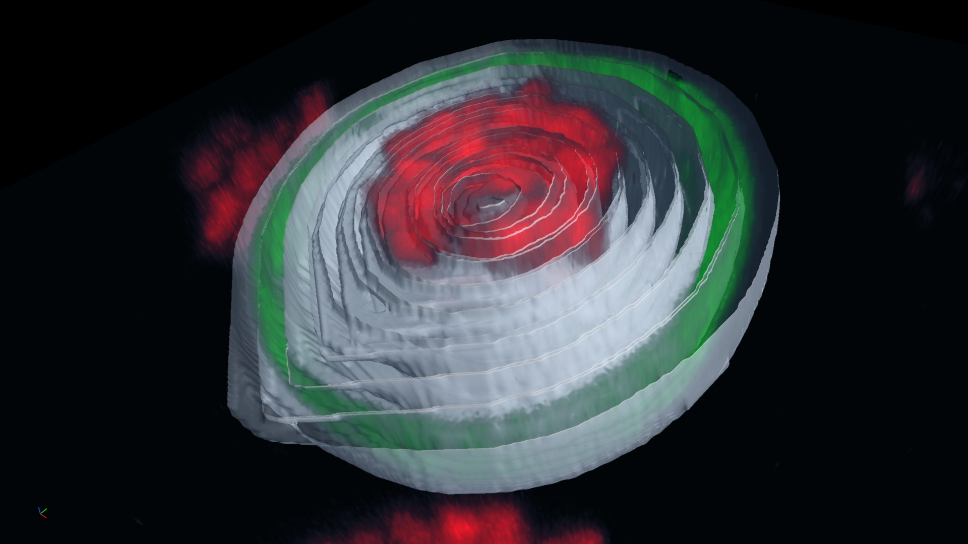 Chromatin Nucleus 3D Image analysis