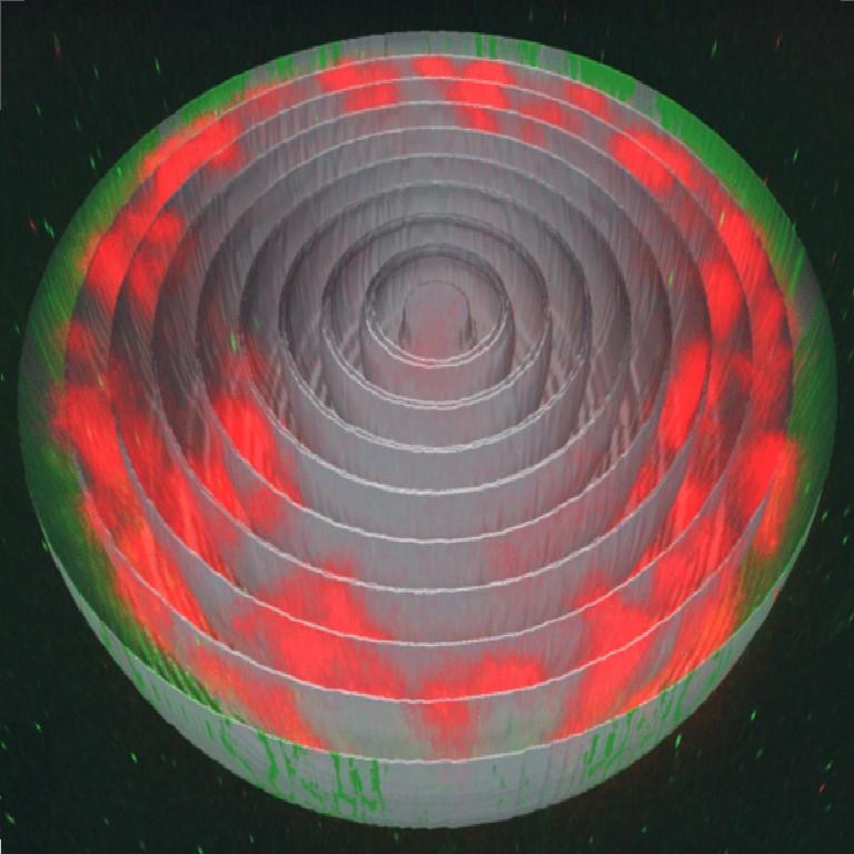 Chromatin in the periphery of the nucleus