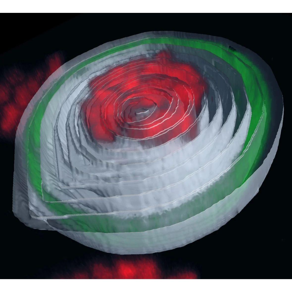 Chromatin collapses towards the nucleus center