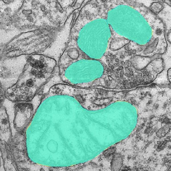 Mitochondria EM image segmentation