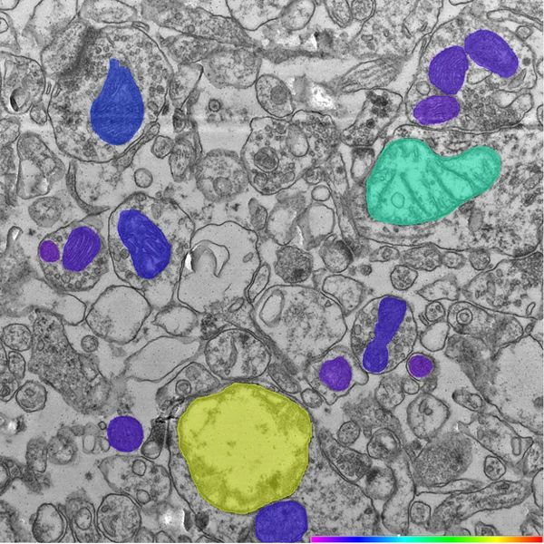 Mitochondria phenotypes classified
