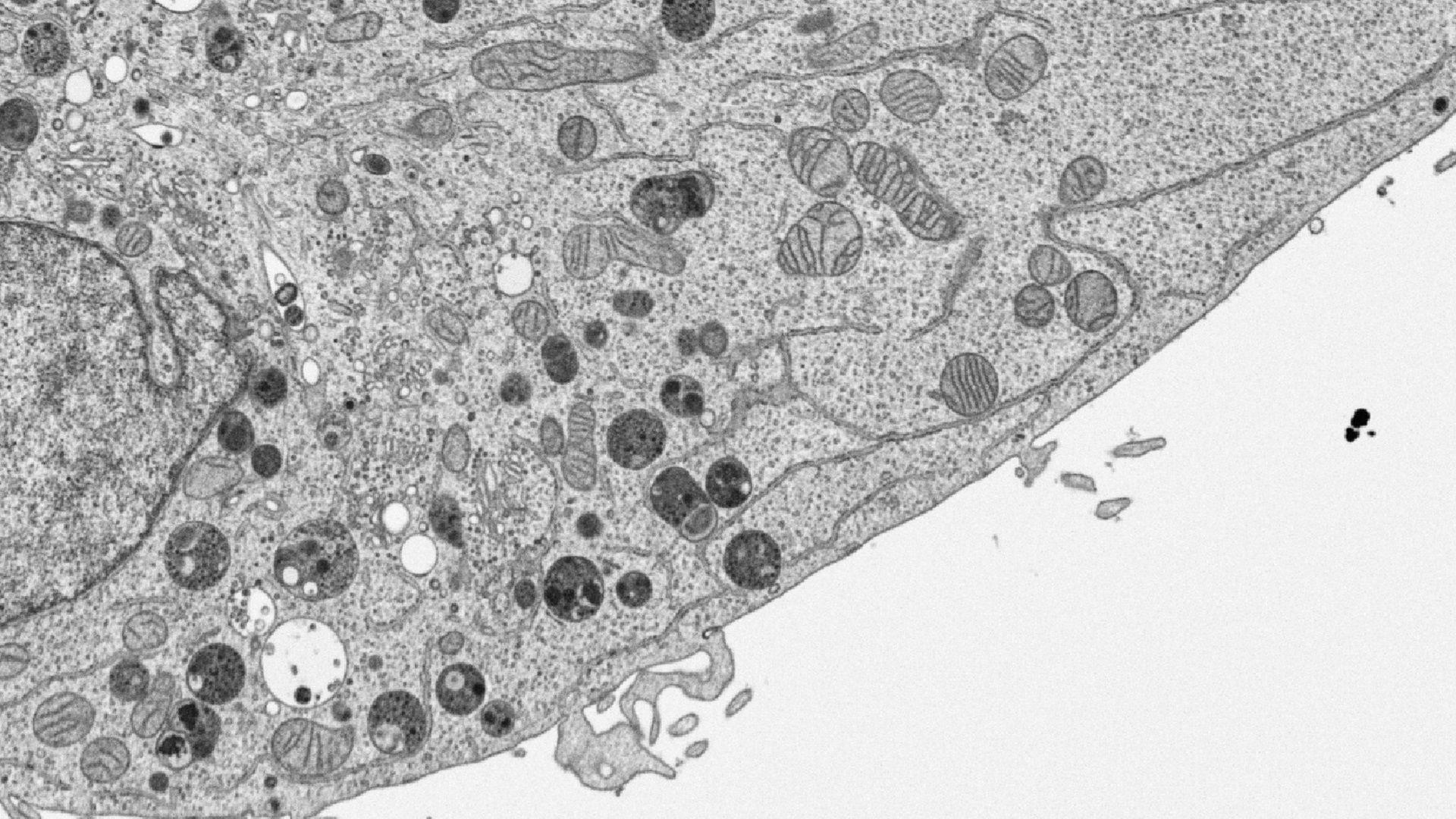 Electron microscopy of HeLa Cell in which sub cellular structures are seen in grey scale