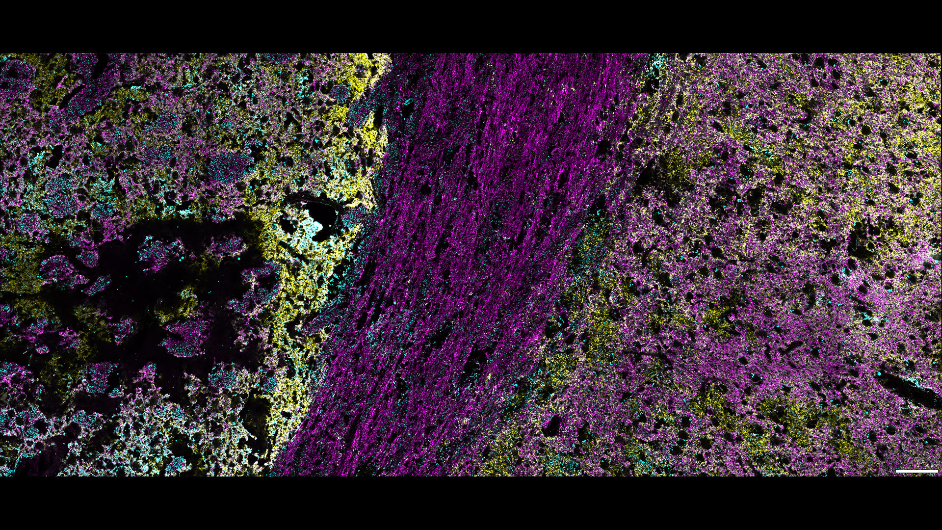 Figure 10: Three marker overlay. Synaptobrevin (blue), Synaptophysin (yellow) and Syntaxin (magenta)