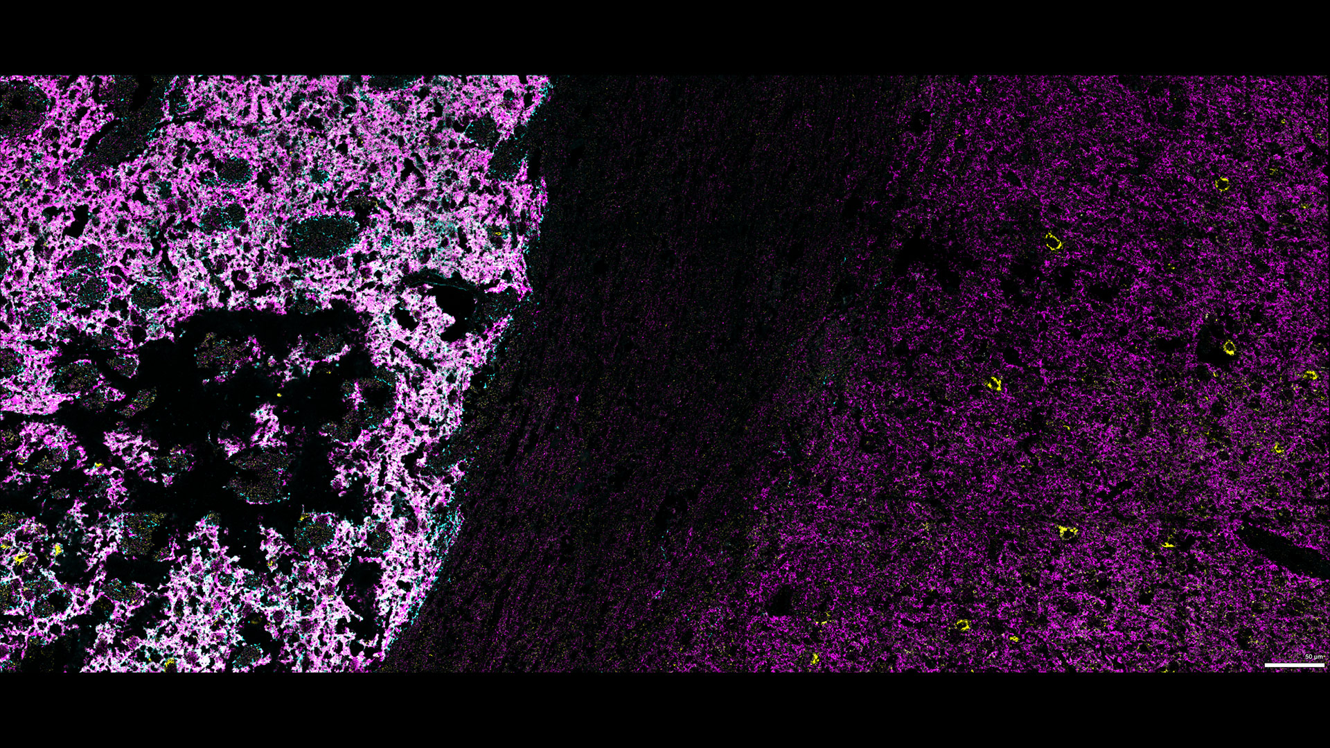 Figure 12: Three marker overlay. CAV2 (blue), GAD (yellow), and DAT (magenta)