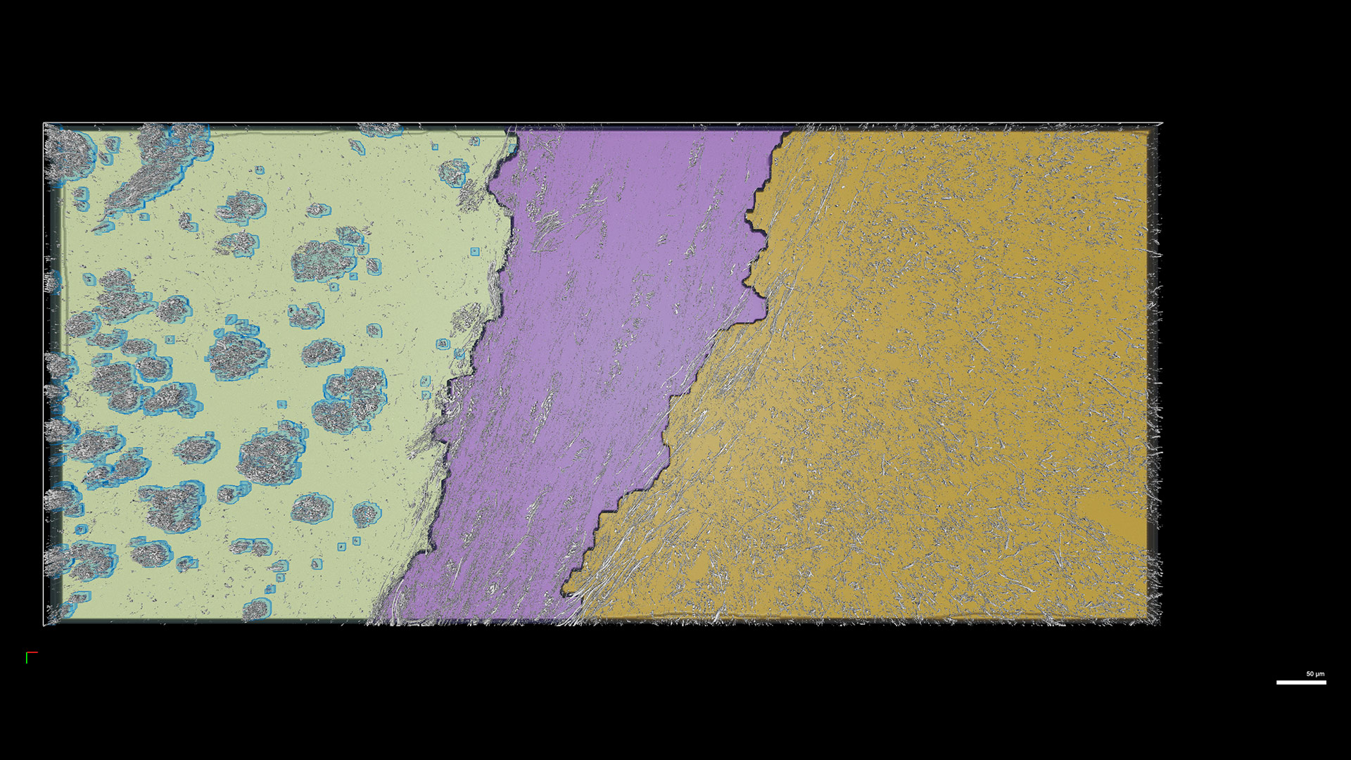 Segmentation of anatomical regions