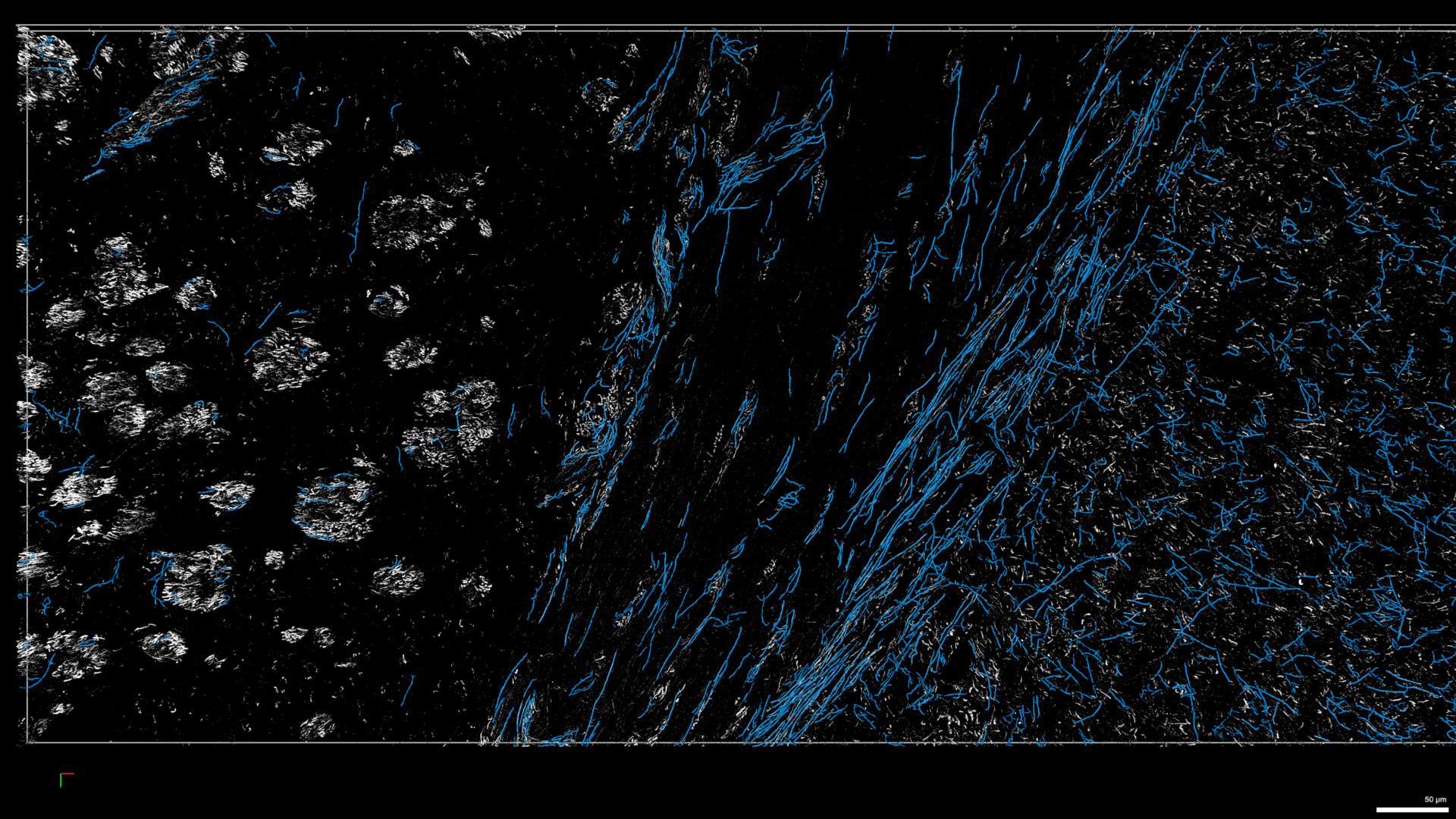 Figure 15: Segmentation of MAP2 filaments