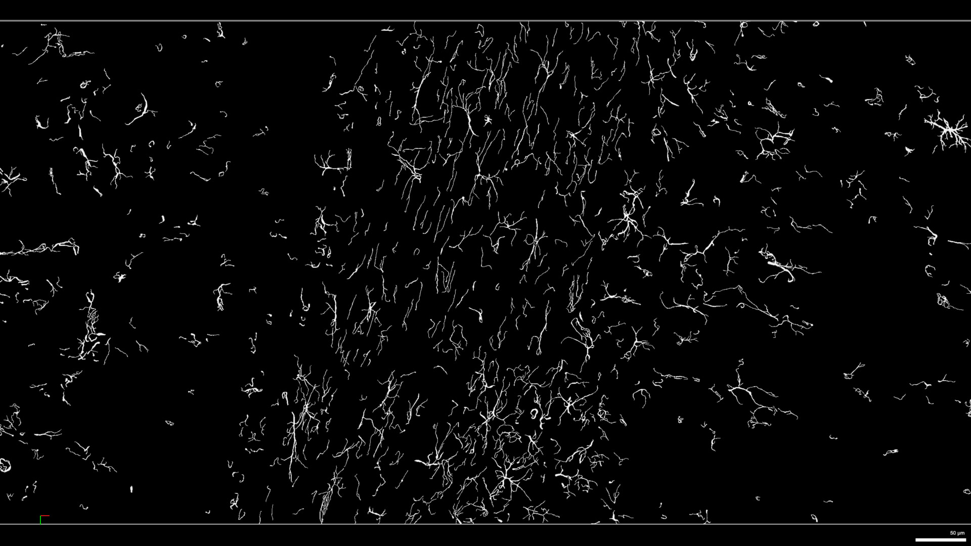 Figure 16: Segmentation of GFAP, labeling astrocytes