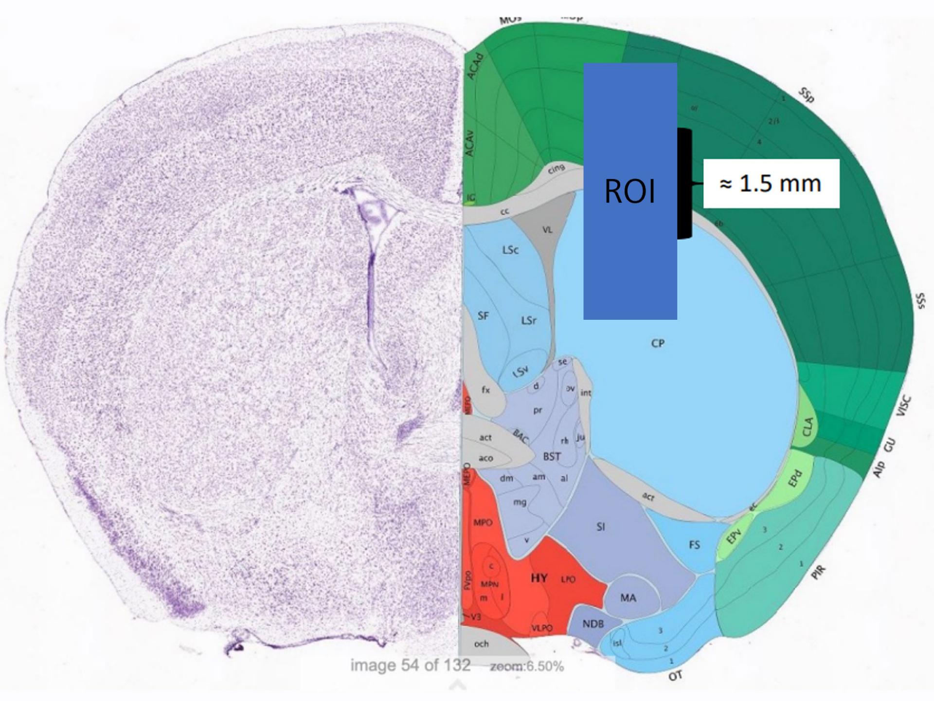 Coronal brain slice