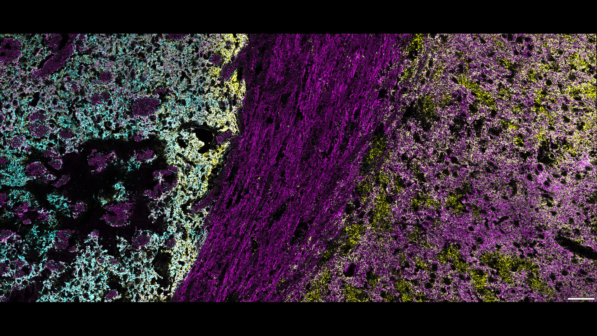 Three marker overlay. DAT (blue), Synaptophysin (yellow) and Syntaxin (magenta)