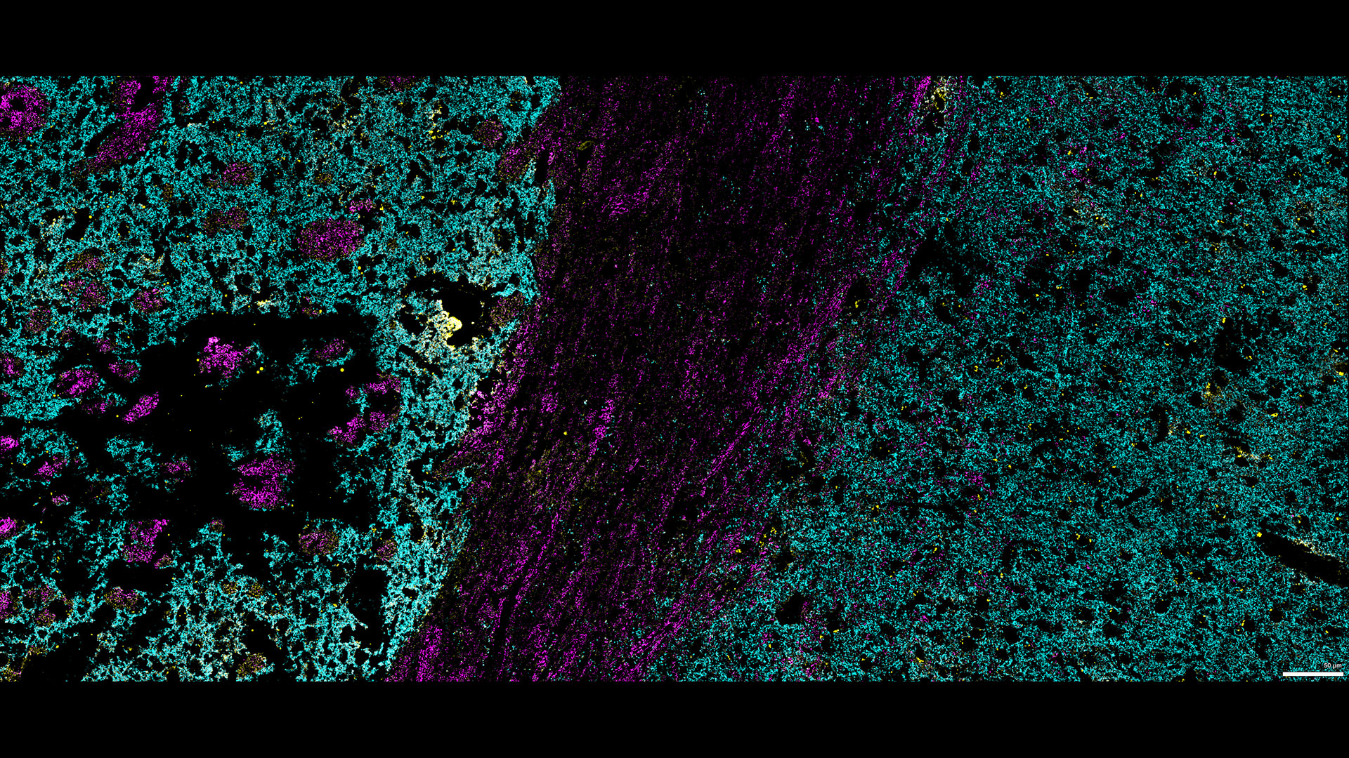 Figure 7: Three marker overlay. Bassoon (blue), Synaptobrevin (yellow) and Piccolo (magenta)