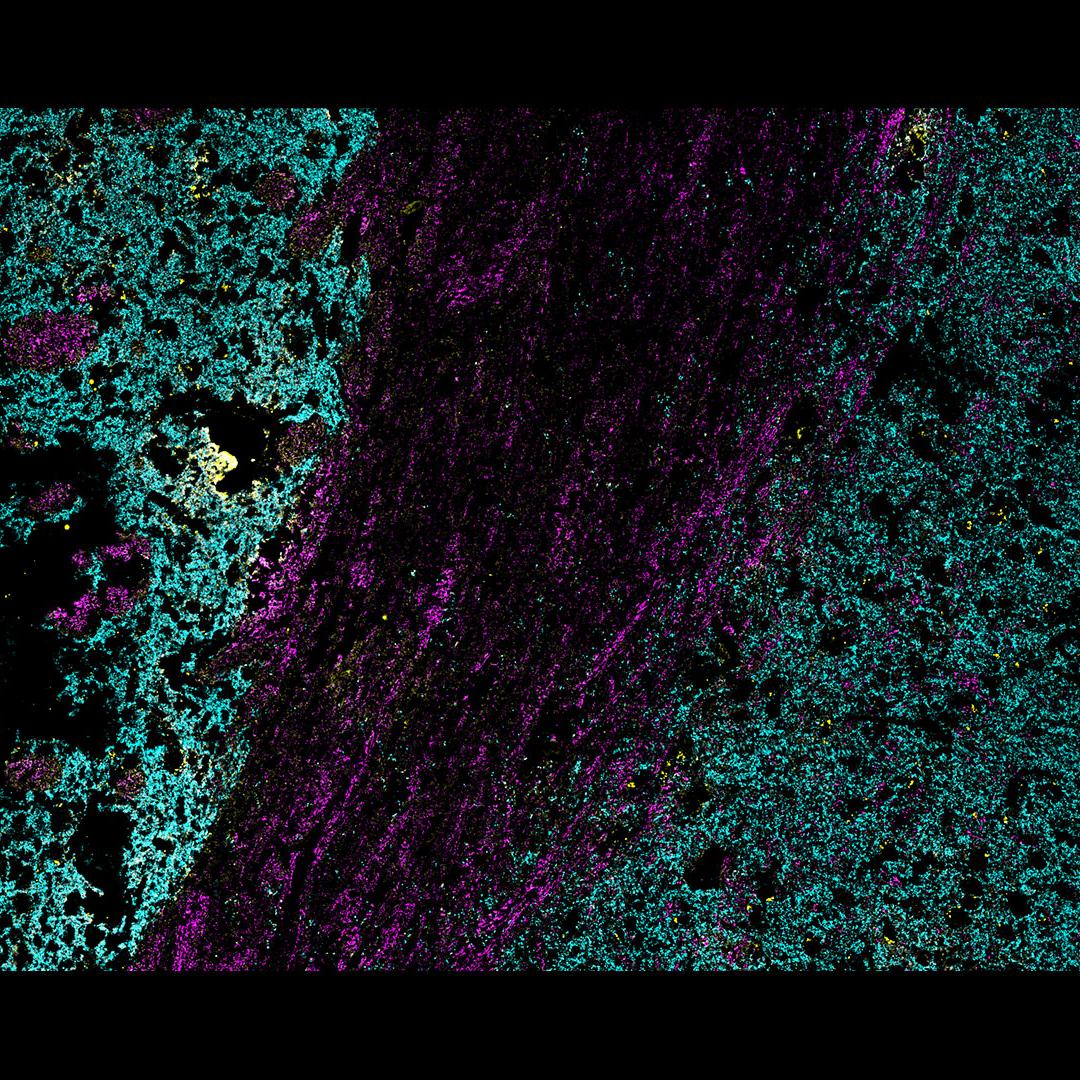 Figure 7 Three marker overlay. Bassoon (blue), Synaptobrevin (yellow) and Piccolo (magenta)