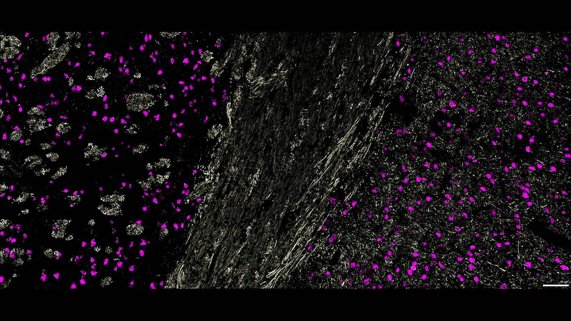 Figure 8: Three marker overlay. CXCL12 (blue), MAP2 (yellow) and NeuN (magenta)