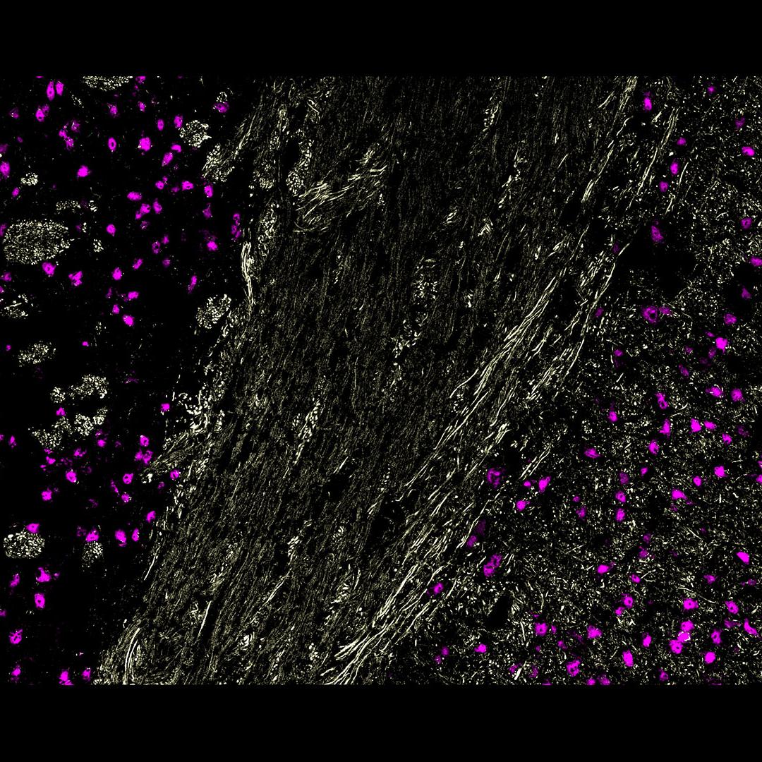 Figure 8 Three marker overlay. CXCL12 (blue),  MAP2 (yellow) and NeuN (magenta)