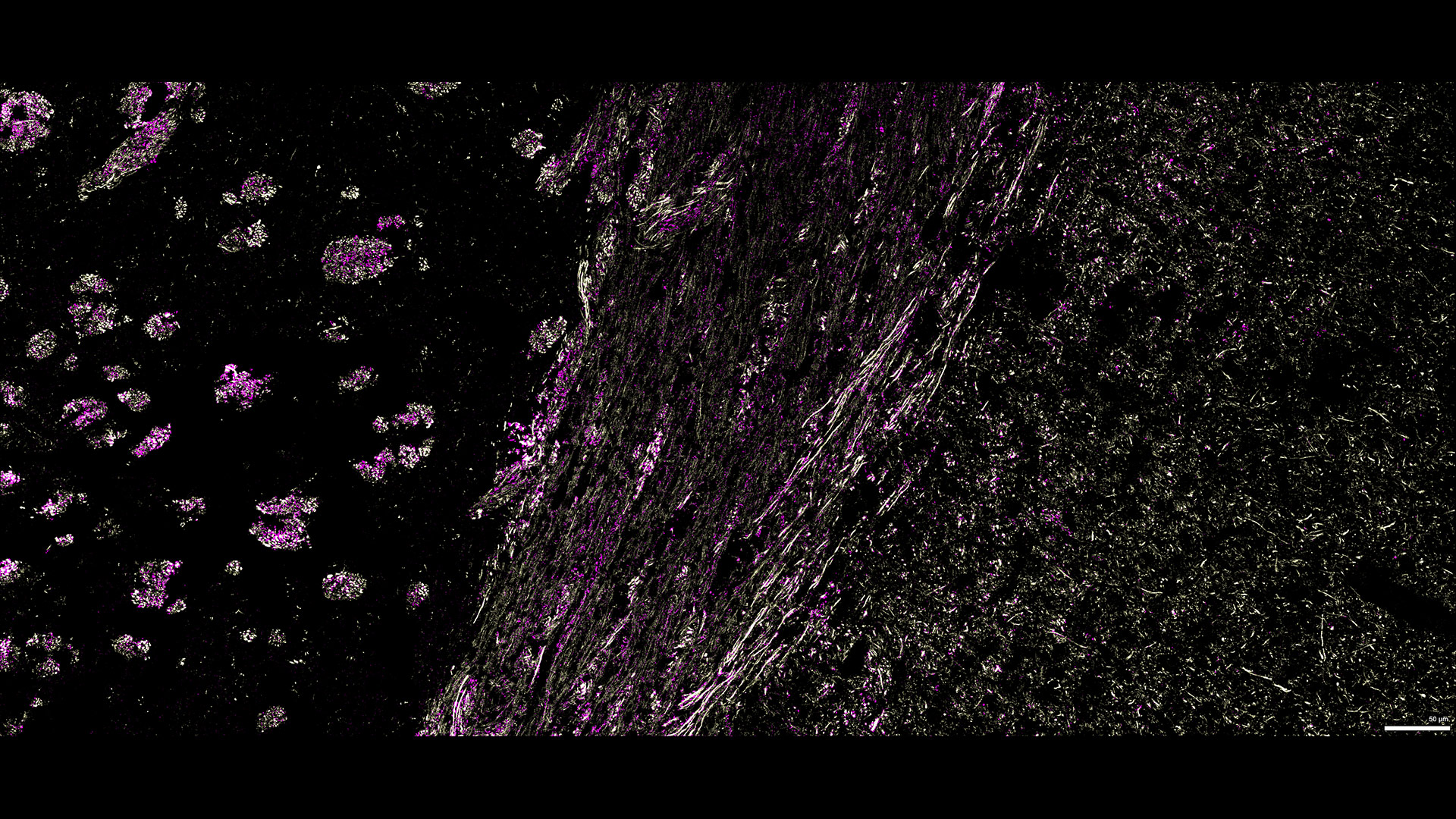 Figure 9: Three marker overlay. CXCL12 (blue), MAP2 (yellow) and Piccolo (magenta)