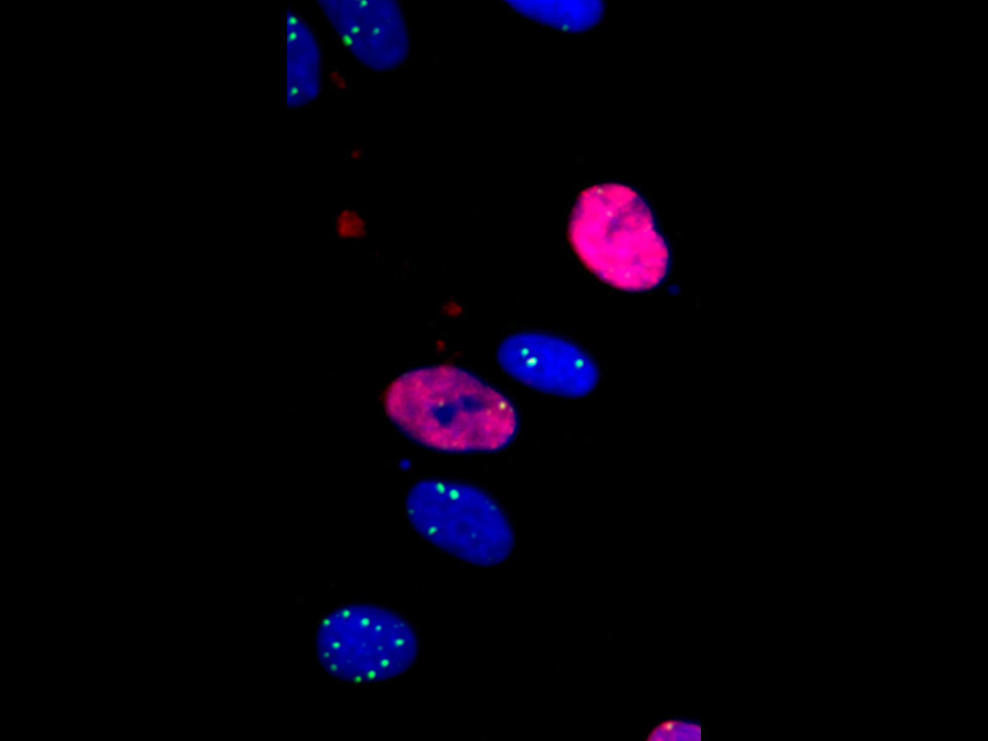 Figure 1B: Detection of DNA-damage foci