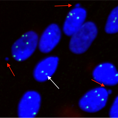 2D slice view on data set with vesicles​