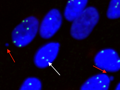 2D slice view on data set with vesicles​