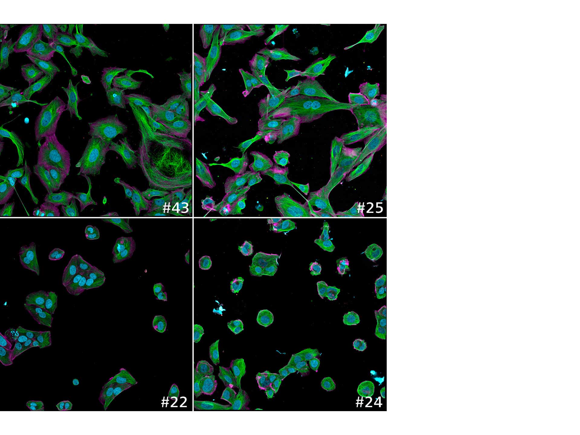 Figure 8a: Example images showing the variation of quantitative read-outs within the data set; here cell body size is shown. Sample IDs are shown with every image.