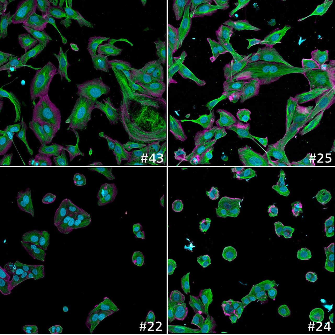 Figure 8a: Example images showing the variation of quantitative read-outs within the data set; here cell body size is shown. Sample IDs are shown with every image.