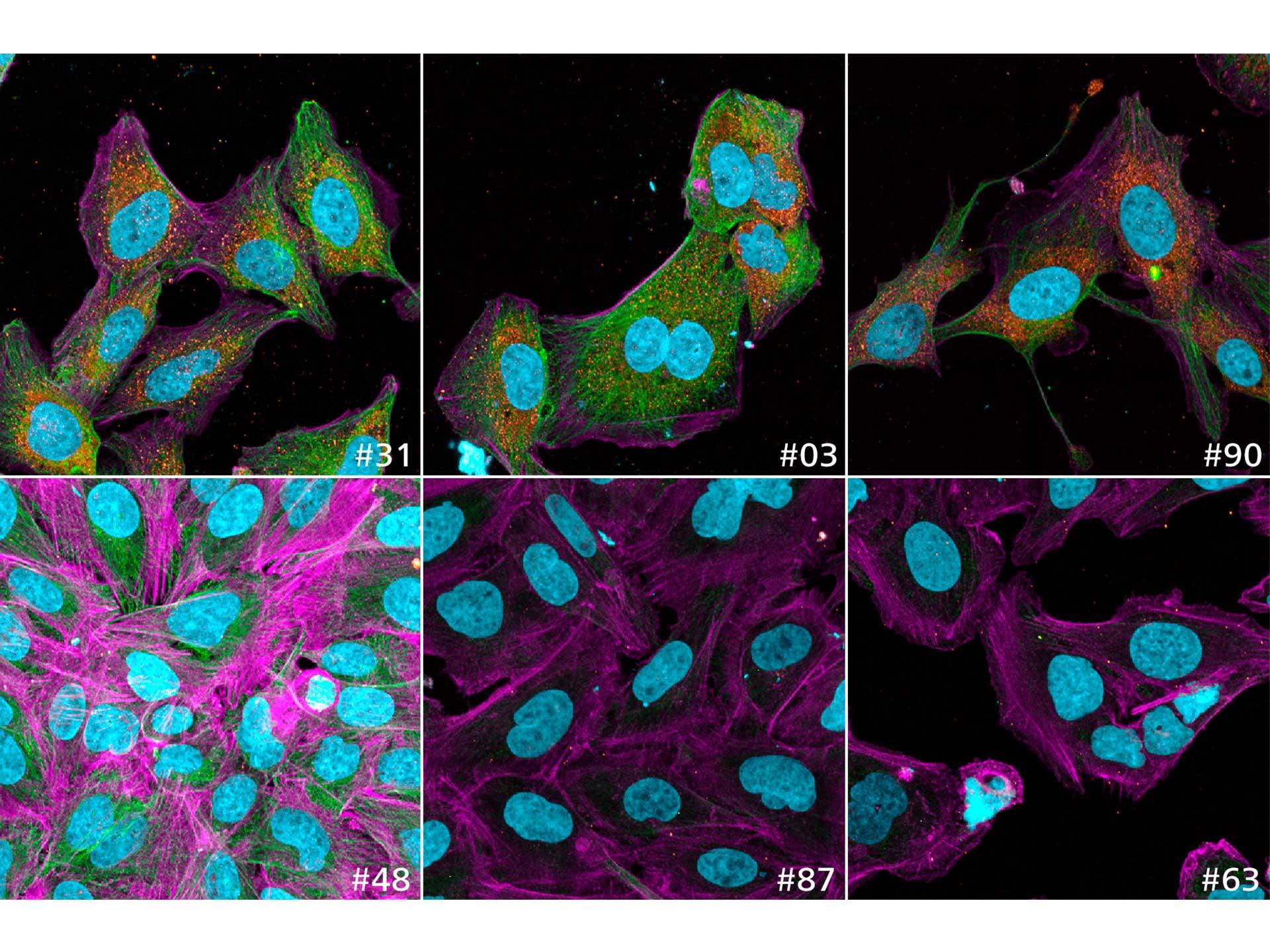 Figure 8b: Example images showing the variation of quantitative read-outs within the data set; here focal adhesion intensity (orange) is shown. Sample IDs are shown with every image.