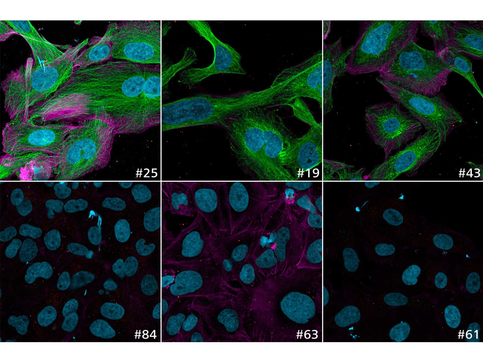 Figure 8d: Example images showing the variation of quantitative read-outs within the data set; here microtubule intensity is shown (green). Sample IDs are shown with every image.