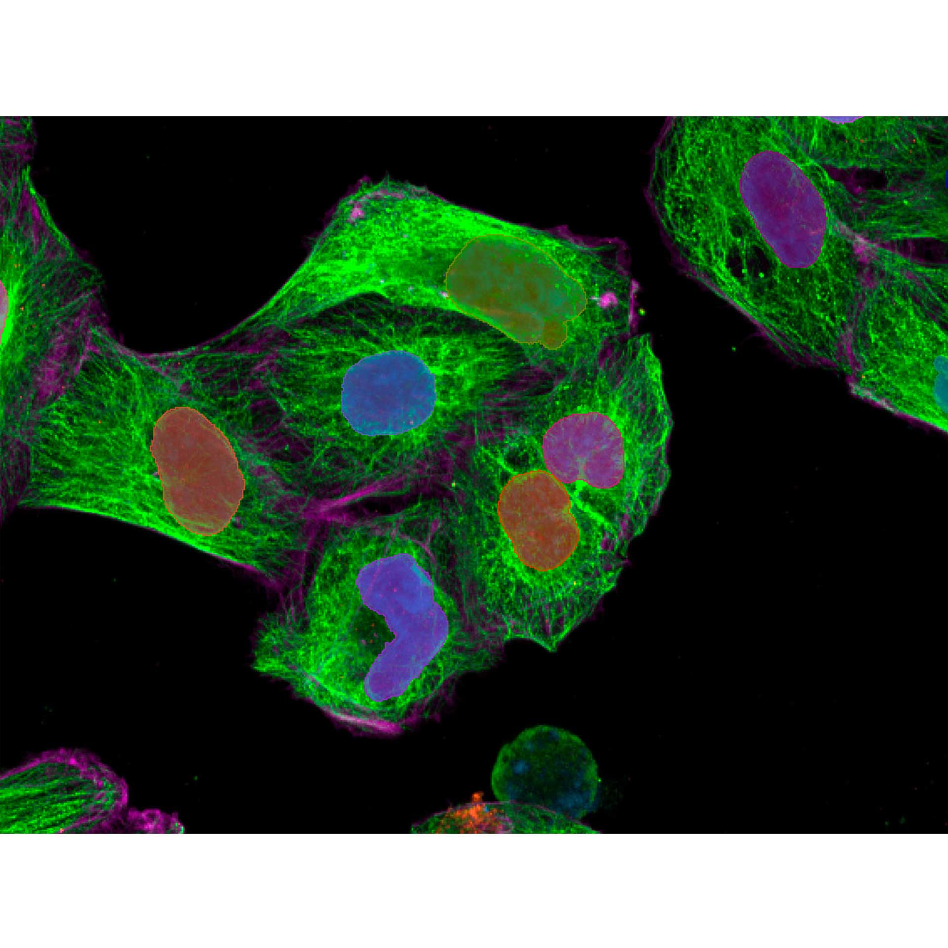 Figure 5: Three-step segmentation process for detection of cell bodies. First, nuclei are detected based on Hoechst channel. Second, cell areas are detected by Region Growing from nucleus segments based on Actin channel. Third, final Cell Body segments are detected by Region Growing based on merged channels. 