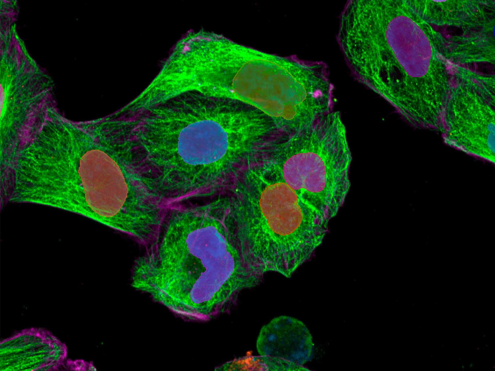 Figure 5: Three-step segmentation process for detection of cell bodies. First, nuclei are detected based on Hoechst channel. Second, cell areas are detected by Region Growing from nucleus segments based on Actin channel. Third, final Cell Body segments are detected by Region Growing based on merged channels.