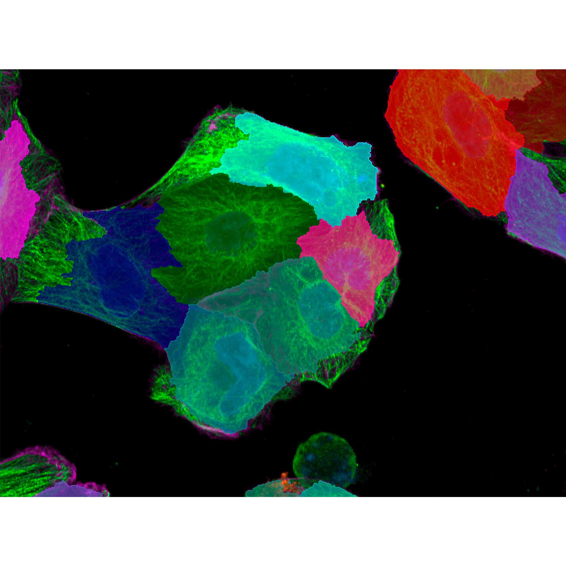 Figure 5: Three-step segmentation process for detection of Cell Bodies: Cell areas are detected by Region Growing from nucleus segments based on Actin channel.  