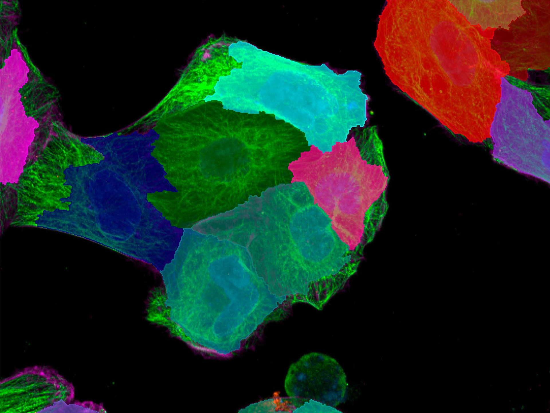 Figure 5: Three-step segmentation process for detection of Cell Bodies: Cell areas are detected by Region Growing from nucleus segments based on Actin channel. 