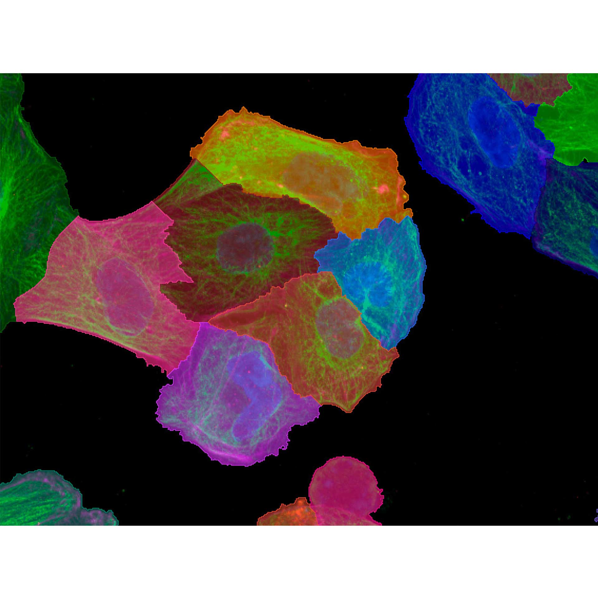 Figure 5: Three-step segmentation process for detection of Cell Bodies: Cell areas are detected by Region Growing from nucleus segments based on Actin channel.  