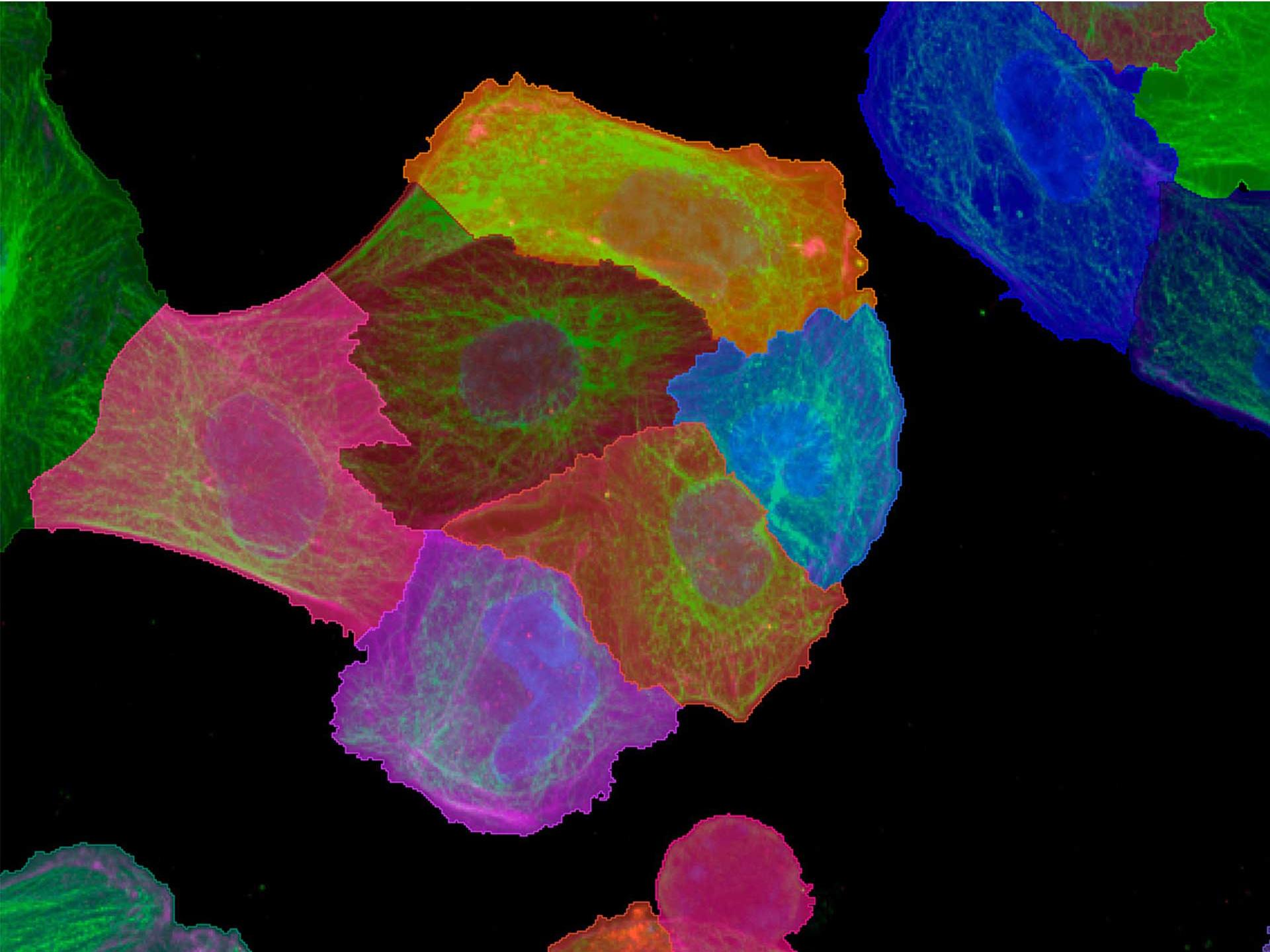 Figure 5: Three-step segmentation process for detection of Cell Bodies: Cell areas are detected by Region Growing from nucleus segments based on Actin channel. 