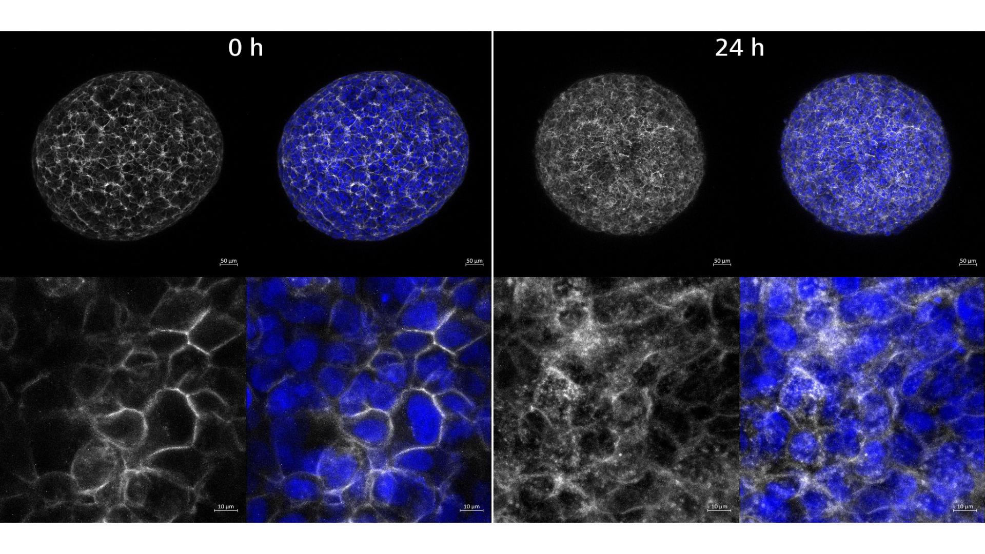 TZ-AF647 internalization in BT-474 cancer spheroids