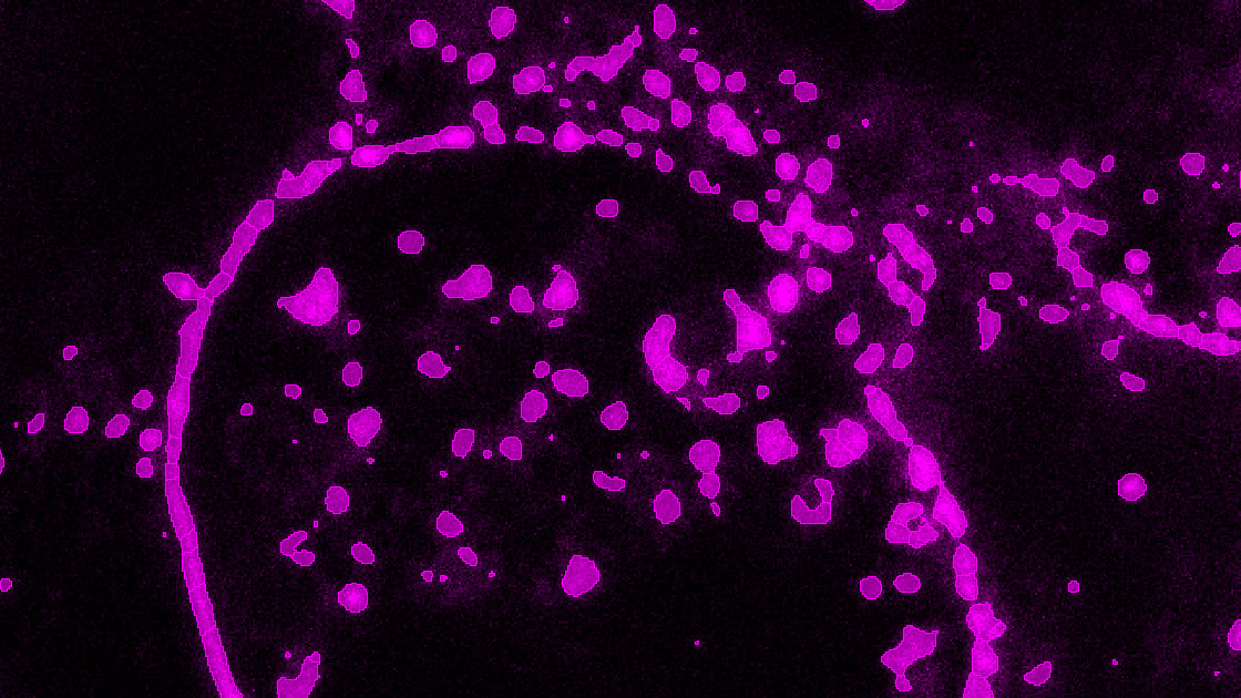 Segmentation quality for TZ-AF647: TZ-AF647 segments